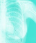 Mammogram_opener